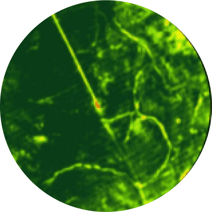 globe